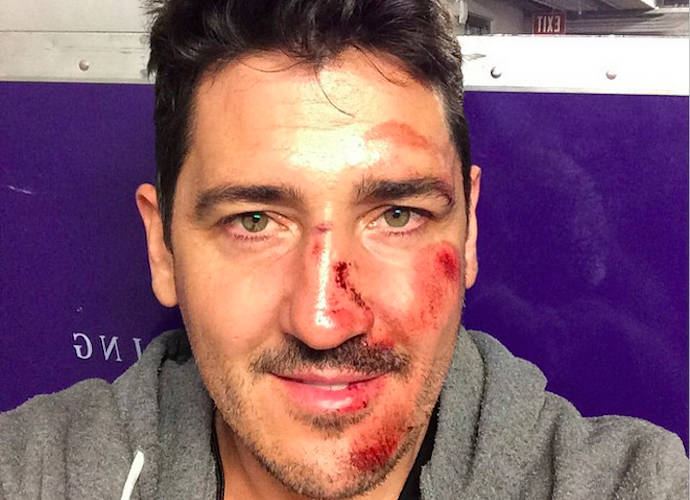 Jonathan Knight Breaks Nose In Tour Bus Accident, Misses NKOTB Show