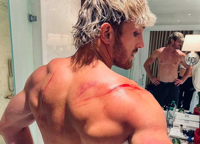 Logan Paul Shows Off Injuries After Being Thrown Through Several Tables In WWE Match