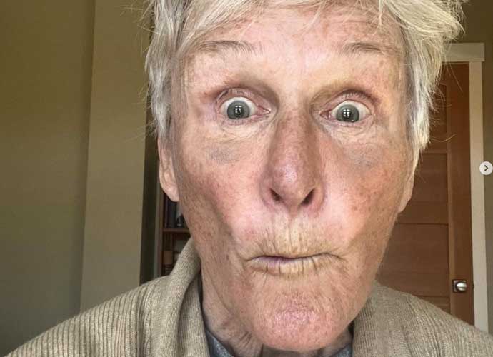 Glenn Close Shares Silly Selfies After Operation For Broken Nose For 77th Birthday