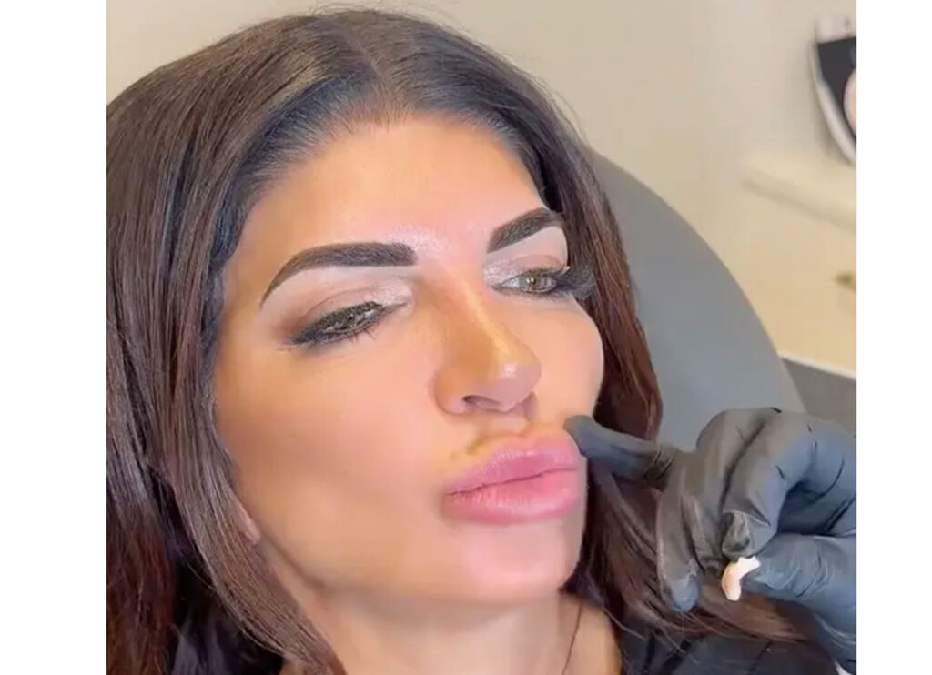 After Fans Mock Her, ‘Real Housewives’ Star Teresa Giudice Dissolves Her Lip Fillers – On TikTok