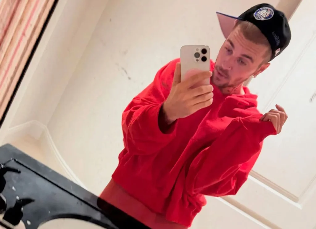 Fans Accuse Justin Bieber Of ‘Turning Into Britney Spears’ After New Posts Spark Concern For His Mental Health