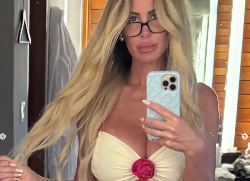 ‘Real Housewives’ Star Kim Zolciak Reveals Her Extensive Cosmetic Surgery History: ‘Filler Became Like Diet Coke’