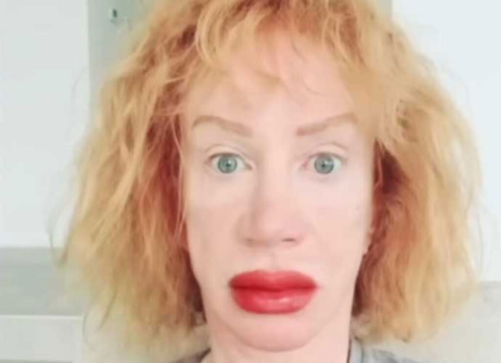 Kathy Griffin Confirms Her Third Facelift After Making Headlines During Public Appearance