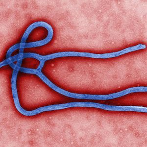 Dallas Nurse Becomes Second Person Diagnosed With Ebola In United States