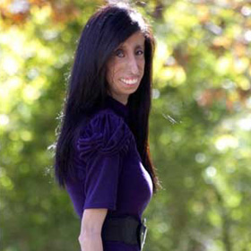 Lizzie Velasquez Weighs 59 Pounds, Can't Gain Weight