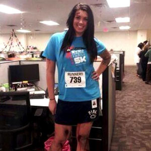 Alicia Ann Lynch, 22, Harassed After Photo Of Her Dressed As Boston Marathon Bombing Victim For Halloween Goes Viral